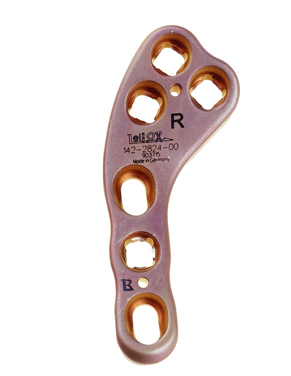 פלטת Leilox TPLO Swing 2.4, באורך 33 מ"מ, טיטניום, צד ימין